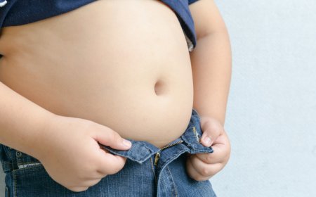 The surgical option: For some, stomach stapling is last hope